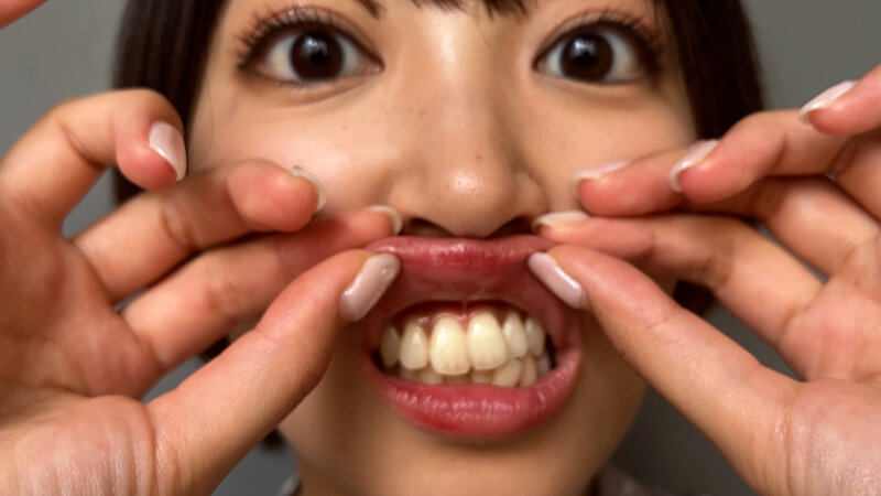街角口内02のサムネイル画像